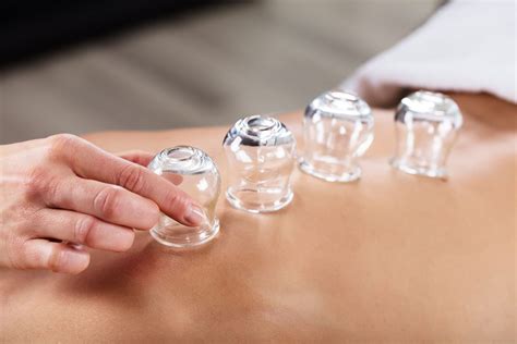 Cupping with Integrative Massage